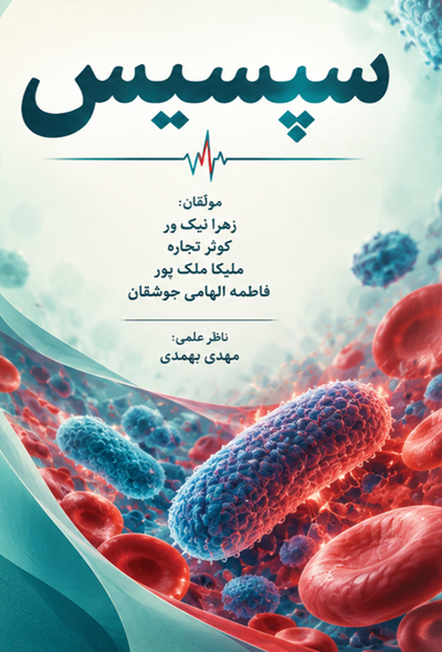 سپسیس